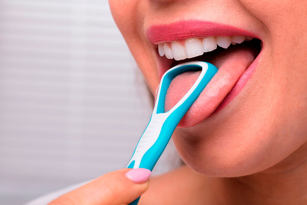 tongschraper en halitosis